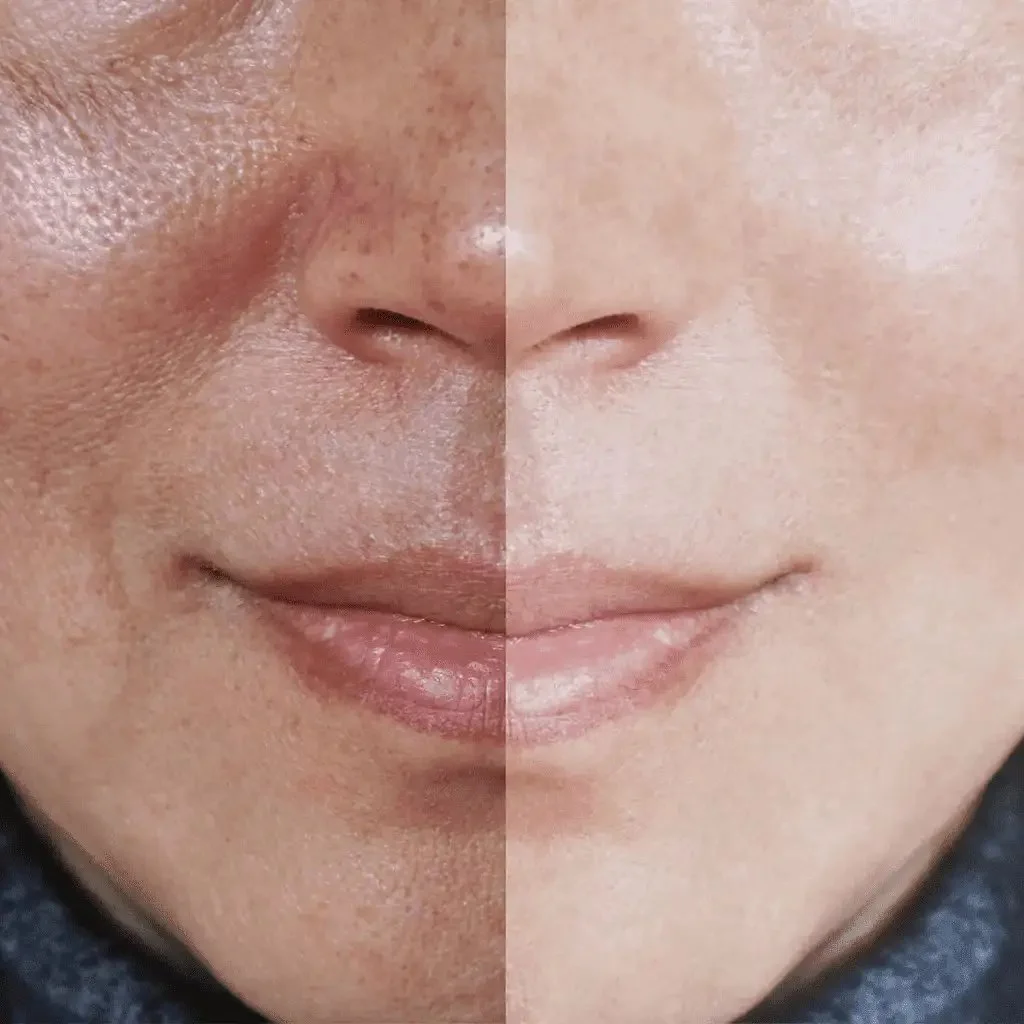 beaforeafter-woman-face (1)