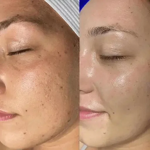 beaforeafter-woman-face1 (1)